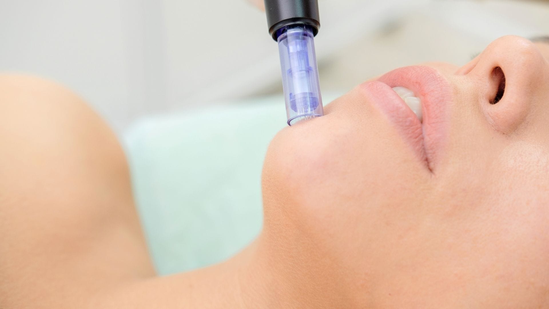 microneedlingul este esential in eliminarea petelor pigmentare si a cicatricilor prin stimularea productiei de colagen si elastina necesare refacerii pielii